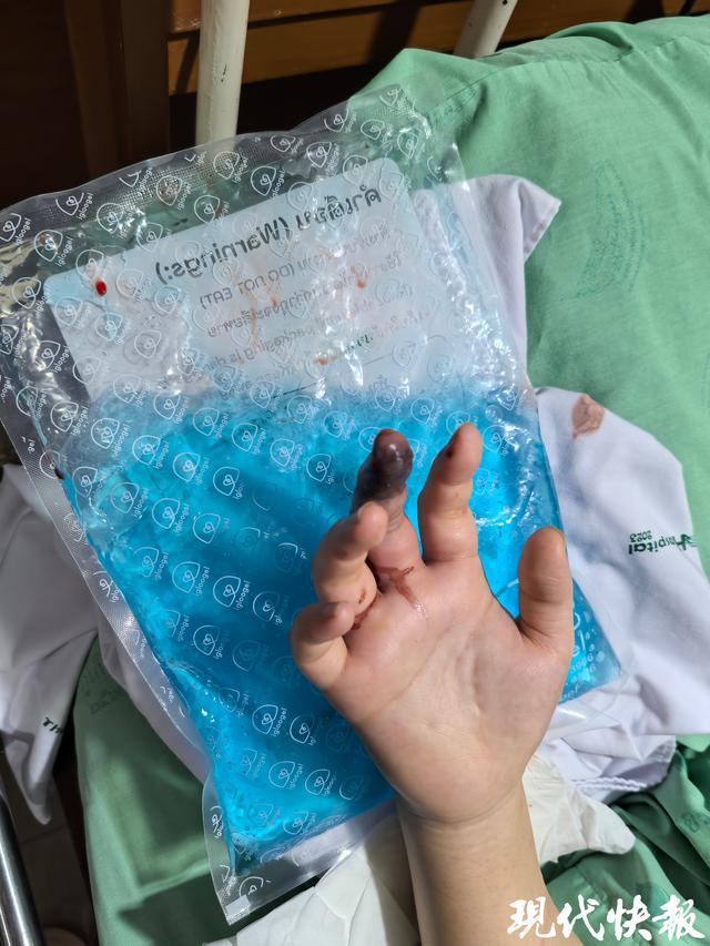 賭博:苏州一女子泰国普吉岛游玩时遭蛇咬伤,伤口溃烂肌肉组织坏死